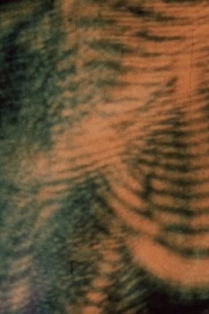 Laserimage