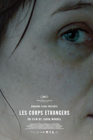 Les corps étrangers