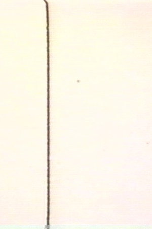 MA (Intervals)