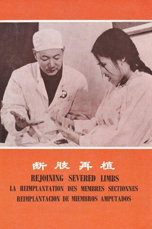 断肢再植