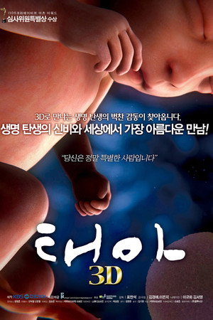 태아 3D