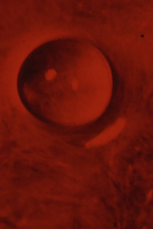 ASCENSION