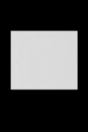 Interval