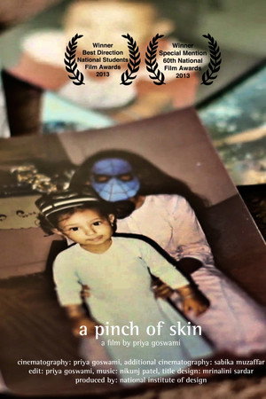 A Pinch of skin