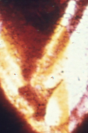 Nodes