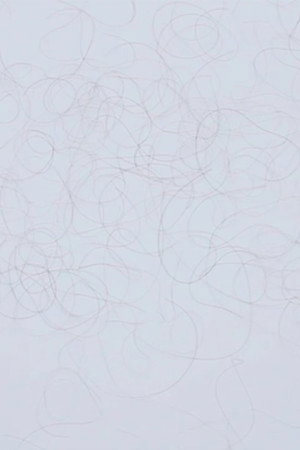 Hairfall