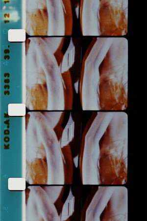 Log Abstract 1986